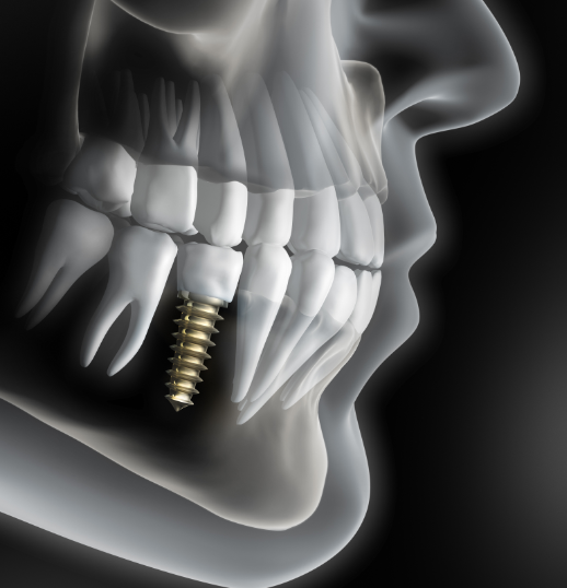 oral and maxillofacial surgeries