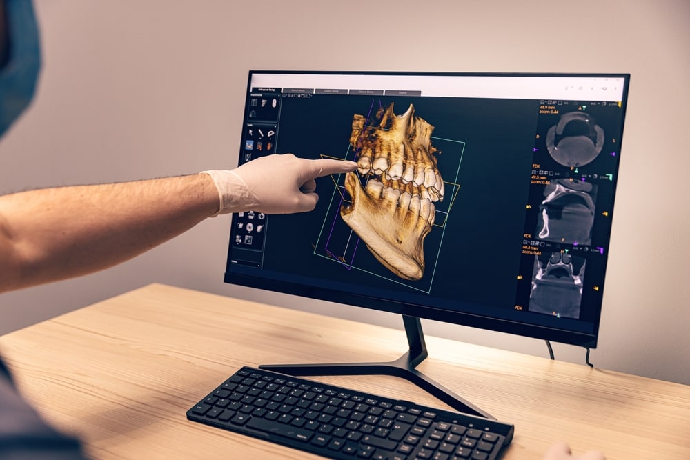Les résultat d'un scan 3D des mâchoires visibles à l'écran